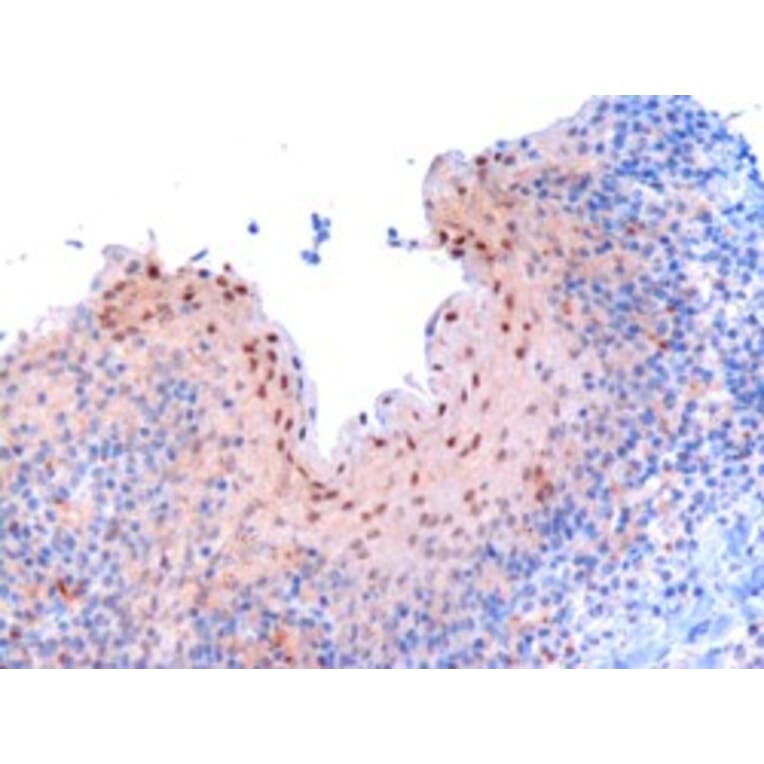 Immunohistochemistry - Anti-RanBP9 Antibody (A82461) - Antibodies.com