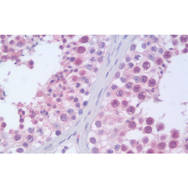 Immunohistochemistry - Anti-RanBP9 Antibody (A82461) - Antibodies.com