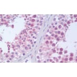 Immunohistochemistry - Anti-RanBP9 Antibody (A82461) - Antibodies.com
