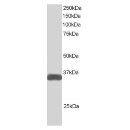 Western Blot - Anti-STRADB Antibody (A82463) - Antibodies.com