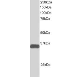 Western Blot - Anti-STRADB Antibody (A82463) - Antibodies.com