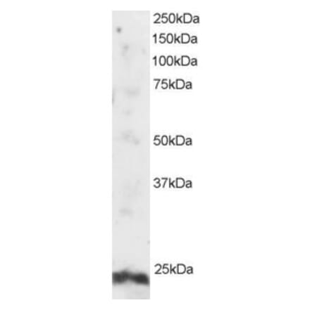 Western Blot - Anti-ARL4A Antibody (A82464) - Antibodies.com