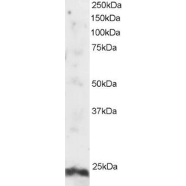Western Blot - Anti-ARL4A Antibody (A82464) - Antibodies.com