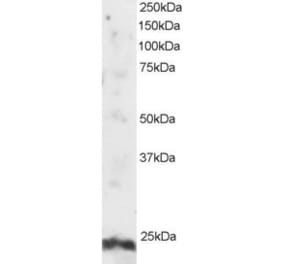 Western Blot - Anti-ARL4A Antibody (A82464) - Antibodies.com