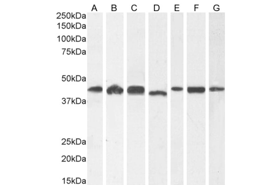 Western Blot - Anti-ARP1 Antibody (A82465) - Antibodies.com