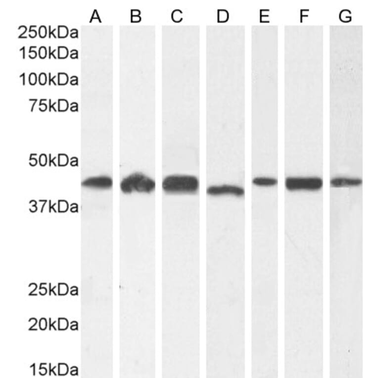 Western Blot - Anti-ARP1 Antibody (A82465) - Antibodies.com