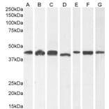 Western Blot - Anti-ARP1 Antibody (A82465) - Antibodies.com