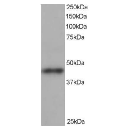 Western Blot - Anti-ACTR1B Antibody (A82466) - Antibodies.com