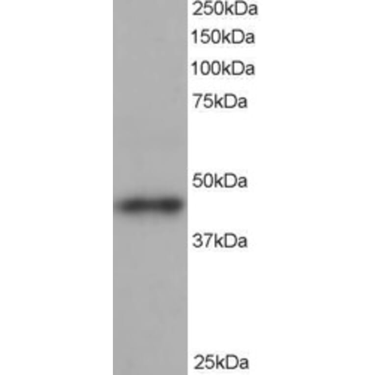 Western Blot - Anti-ACTR1B Antibody (A82466) - Antibodies.com