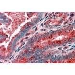 Immunohistochemistry - Anti-ACTR1B Antibody (A82466) - Antibodies.com