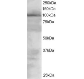 Western Blot - Anti-VAV2 Antibody (A82468) - Antibodies.com