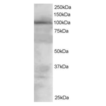 Western Blot - Anti-VAV2 Antibody (A82468) - Antibodies.com