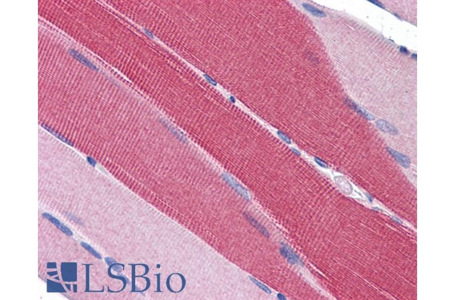 Immunohistochemistry - Anti-PDE4D Antibody (A82469) - Antibodies.com