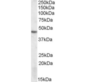 Western Blot - Anti-DRAK2 Antibody (A82470) - Antibodies.com