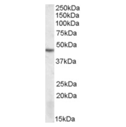 Western Blot - Anti-DRAK2 Antibody (A82470) - Antibodies.com