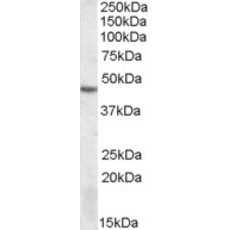 Western Blot - Anti-DRAK2 Antibody (A82470) - Antibodies.com