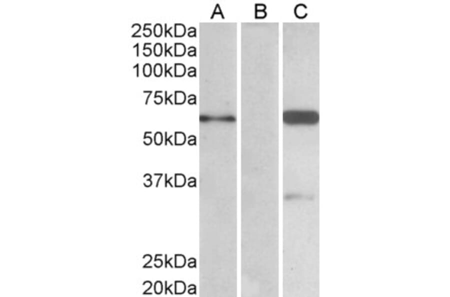 Western Blot - Anti-IRSp53 Antibody (A82471) - Antibodies.com