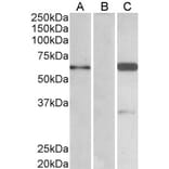 Western Blot - Anti-IRSp53 Antibody (A82471) - Antibodies.com