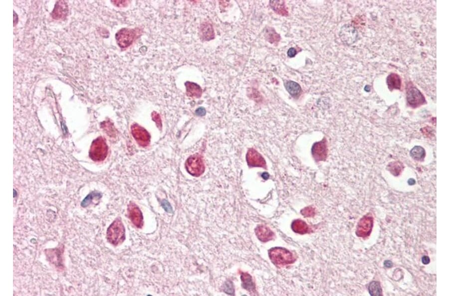 Immunohistochemistry - Anti-IRSp53 Antibody (A82471) - Antibodies.com