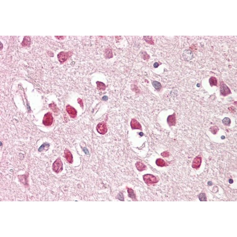 Immunohistochemistry - Anti-IRSp53 Antibody (A82471) - Antibodies.com