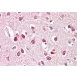 Immunohistochemistry - Anti-IRSp53 Antibody (A82471) - Antibodies.com