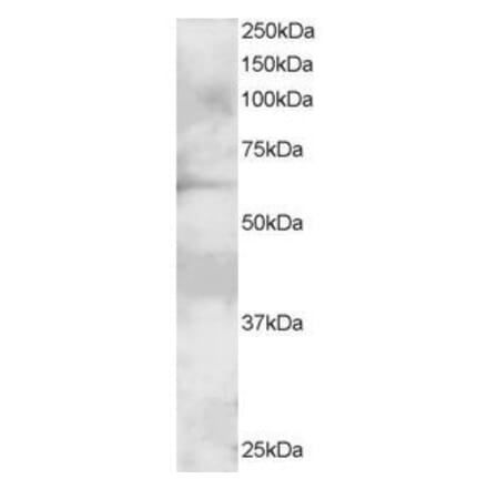 Western Blot - Anti-GRB7 Antibody (A82474) - Antibodies.com