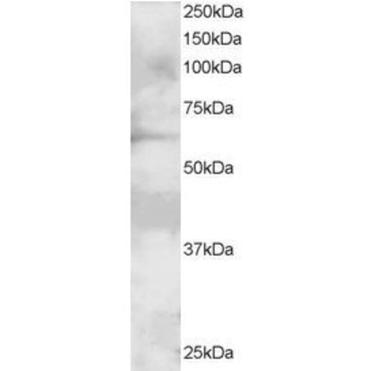 Western Blot - Anti-GRB7 Antibody (A82474) - Antibodies.com