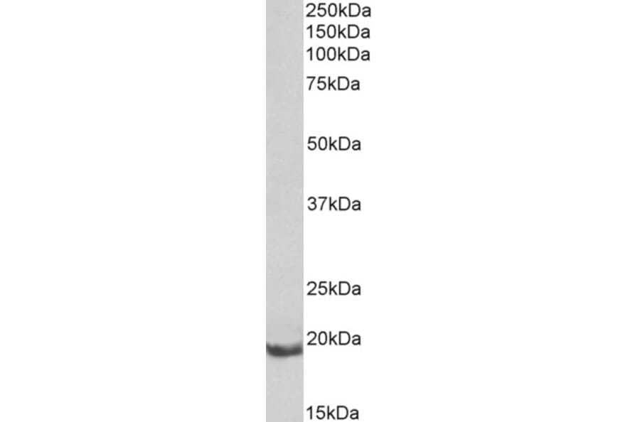 Western Blot - Anti-BFL-1/GRS Antibody (A82475) - Antibodies.com