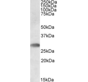 Western Blot - Anti-TLT-1 Antibody (A82476) - Antibodies.com