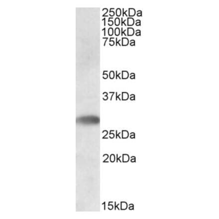 Western Blot - Anti-TREML1 Antibody (A82476) - Antibodies.com