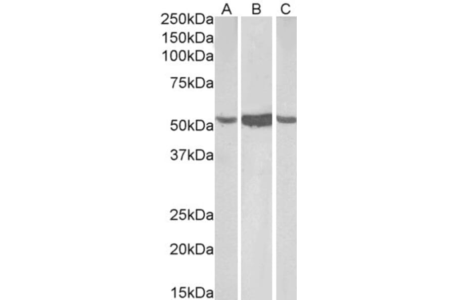 Western Blot - Anti-ALDH1A1 Antibody (A82479) - Antibodies.com