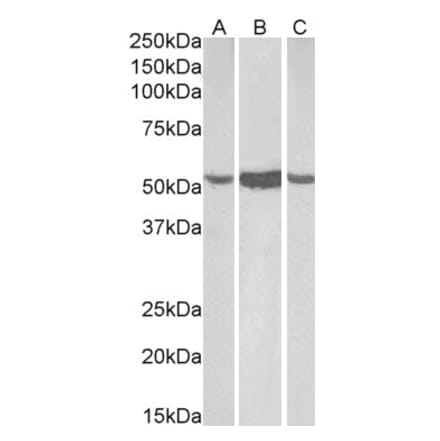 Western Blot - Anti-ALDH1A1 Antibody (A82479) - Antibodies.com