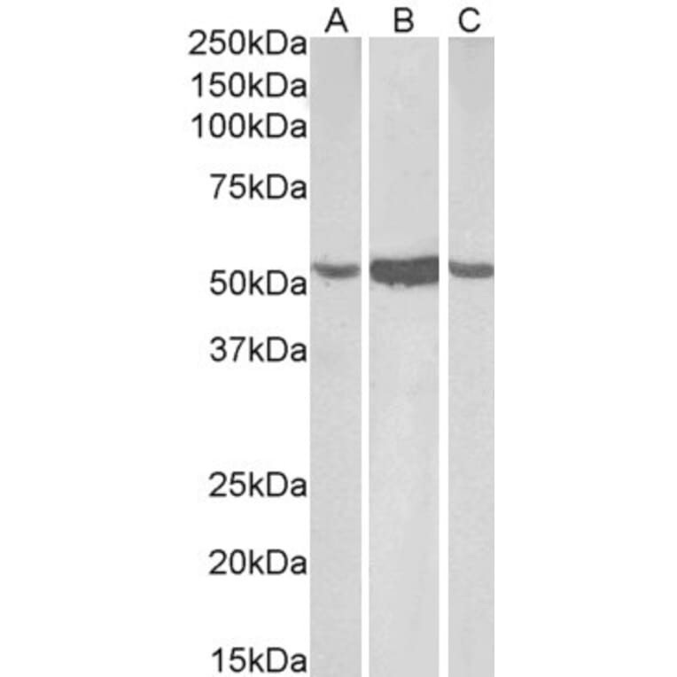 Western Blot - Anti-ALDH1A1 Antibody (A82479) - Antibodies.com