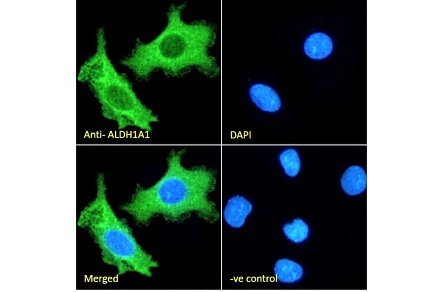 Immunofluorescence - Anti-ALDH1A1 Antibody (A82479) - Antibodies.com