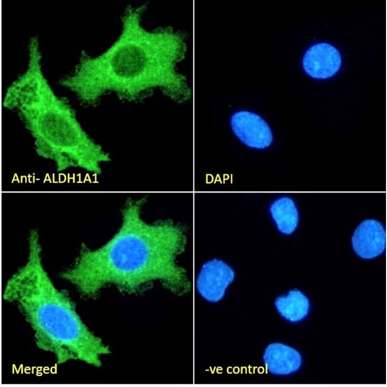 Immunofluorescence - Anti-ALDH1A1 Antibody (A82479) - Antibodies.com