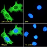 Immunofluorescence - Anti-ALDH1A1 Antibody (A82479) - Antibodies.com