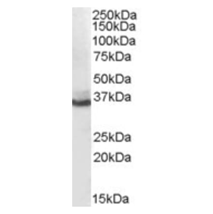 Western Blot - Anti-AKR1C4 Antibody (A82480) - Antibodies.com