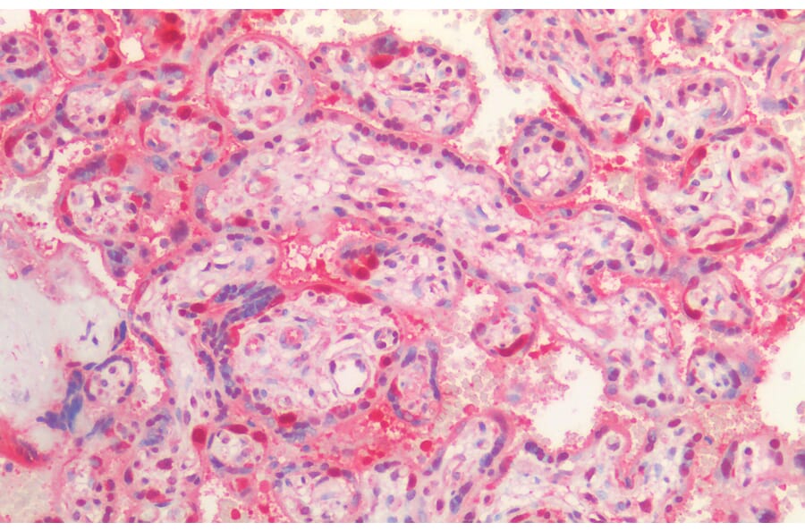 Immunohistochemistry - Anti-VCP Antibody (A82484) - Antibodies.com