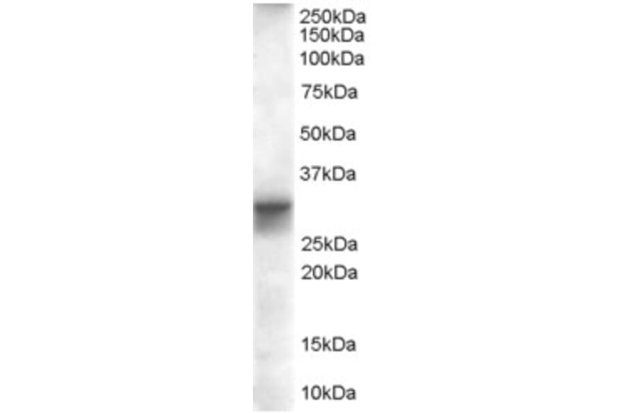Western Blot - Anti-FHL1 Antibody (A82486) - Antibodies.com