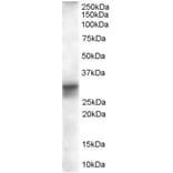 Western Blot - Anti-FHL1 Antibody (A82486) - Antibodies.com