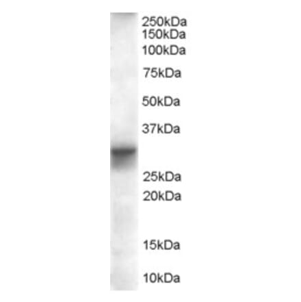 Western Blot - Anti-FHL1 Antibody (A82486) - Antibodies.com