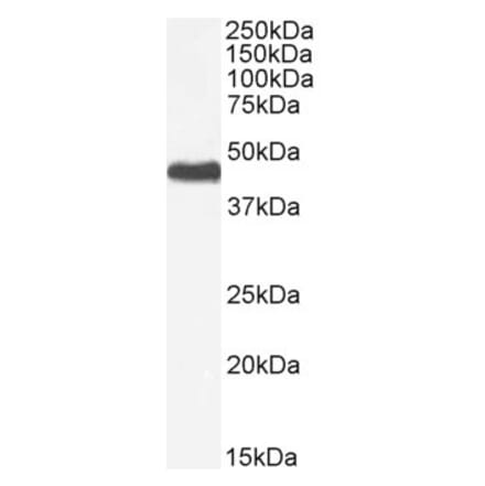 Western Blot - Anti-PNPLA3 Antibody (A82487) - Antibodies.com