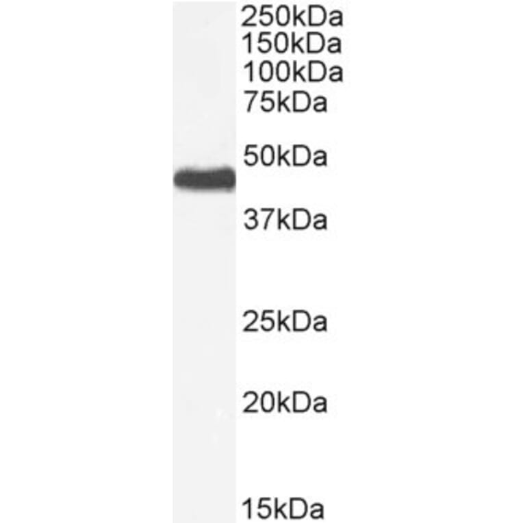 Western Blot - Anti-PNPLA3 Antibody (A82487) - Antibodies.com