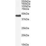 Western Blot - Anti-PNPLA3 Antibody (A82487) - Antibodies.com