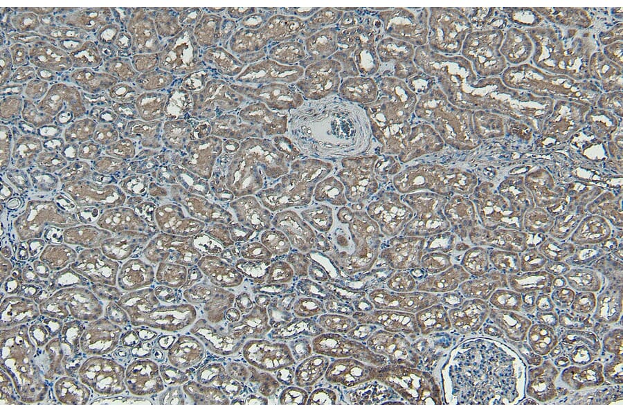 Immunohistochemistry - Anti-PNPLA3 Antibody (A82487) - Antibodies.com