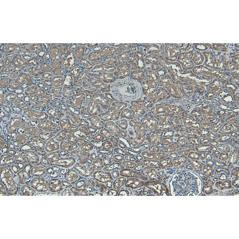 Immunohistochemistry - Anti-PNPLA3 Antibody (A82487) - Antibodies.com