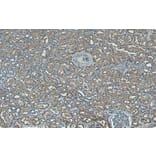 Immunohistochemistry - Anti-PNPLA3 Antibody (A82487) - Antibodies.com