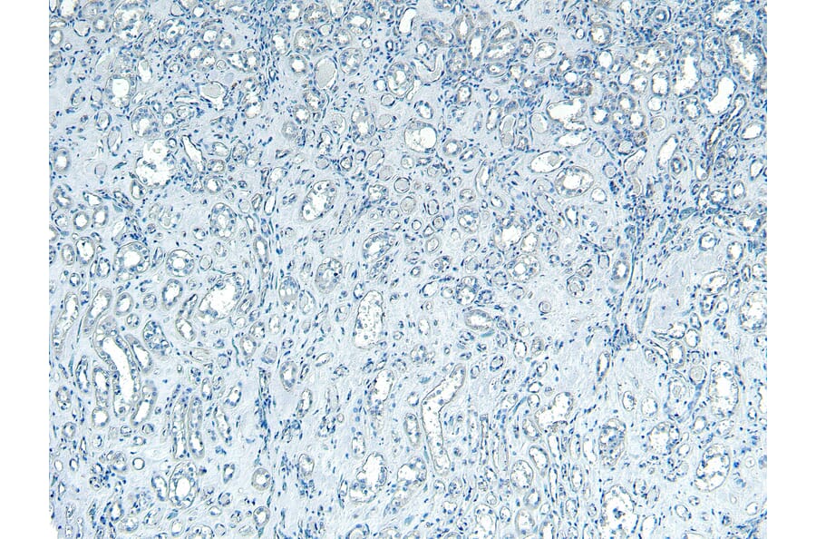 Immunohistochemistry - Anti-PNPLA3 Antibody (A82487) - Antibodies.com