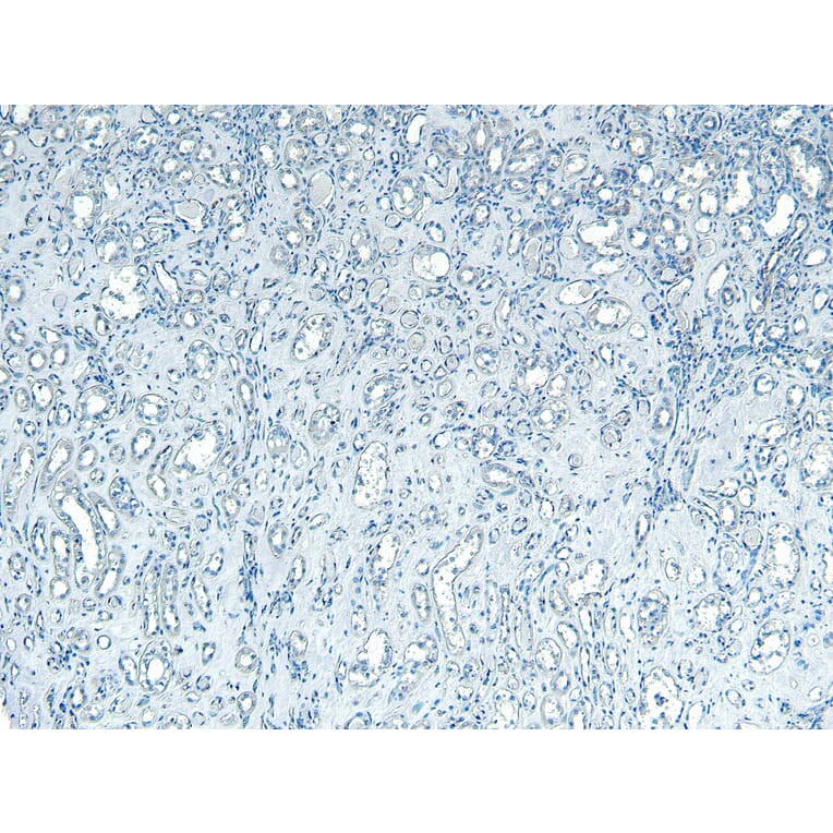 Immunohistochemistry - Anti-PNPLA3 Antibody (A82487) - Antibodies.com