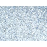 Immunohistochemistry - Anti-PNPLA3 Antibody (A82487) - Antibodies.com